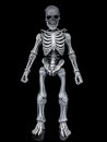 Graveyard Skeletons Actionfiguren 4er-Pack